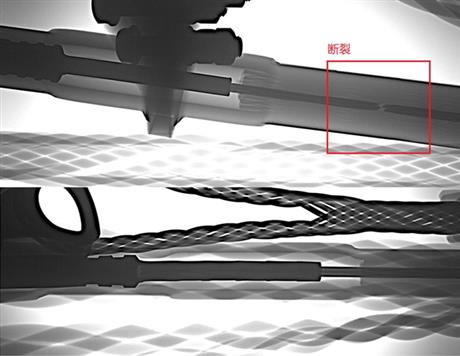 高压线夹成像图片